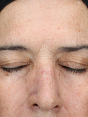 Close up of face after using product